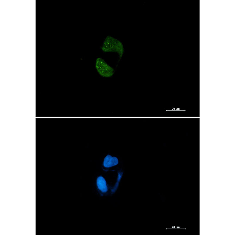 Argonaute 2 Rabbit mAb ABZ1760