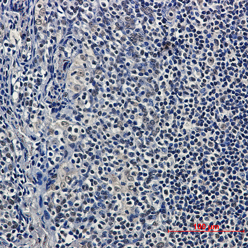HDAC9 Rabbit mAb ABZ1761