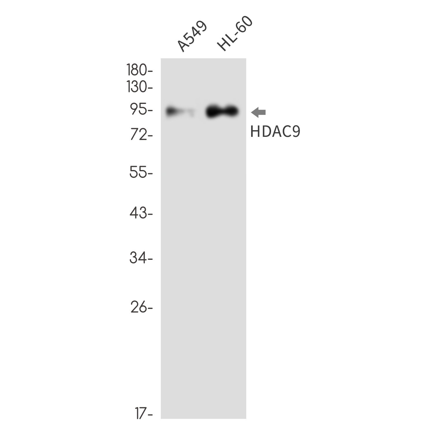 HDAC9 Rabbit mAb ABZ1761