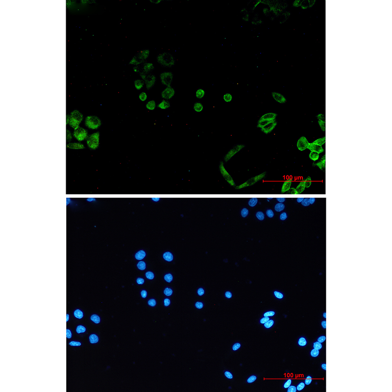PACSIN3 Rabbit mAb ABZ1762