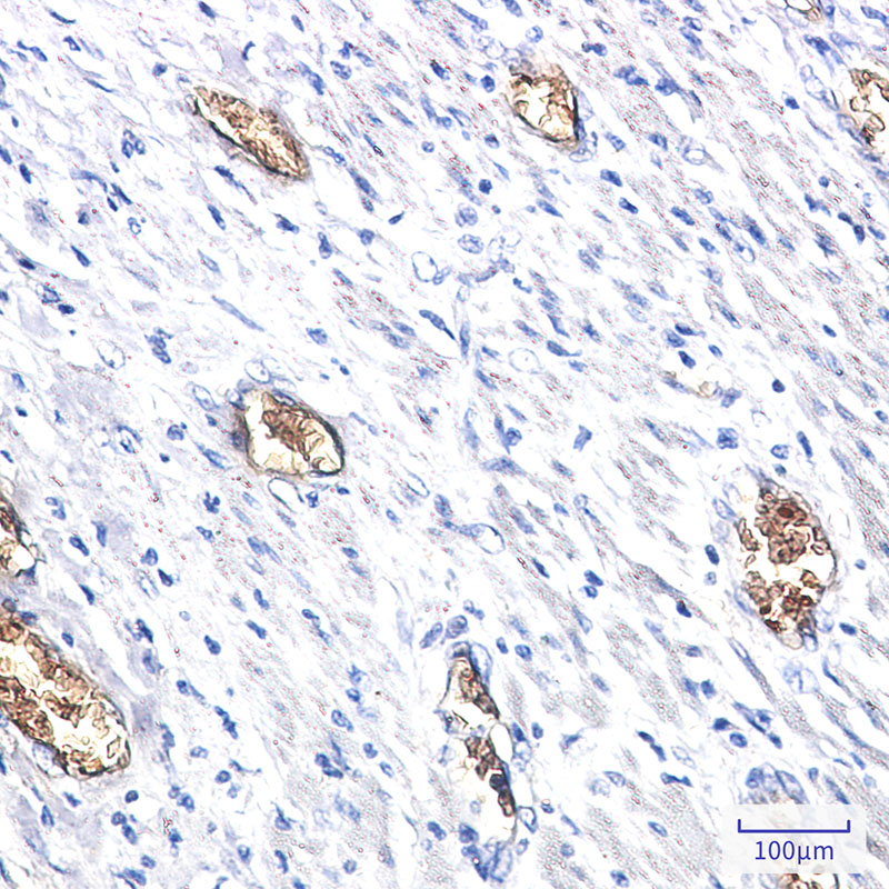 PACSIN3 Rabbit mAb ABZ1762