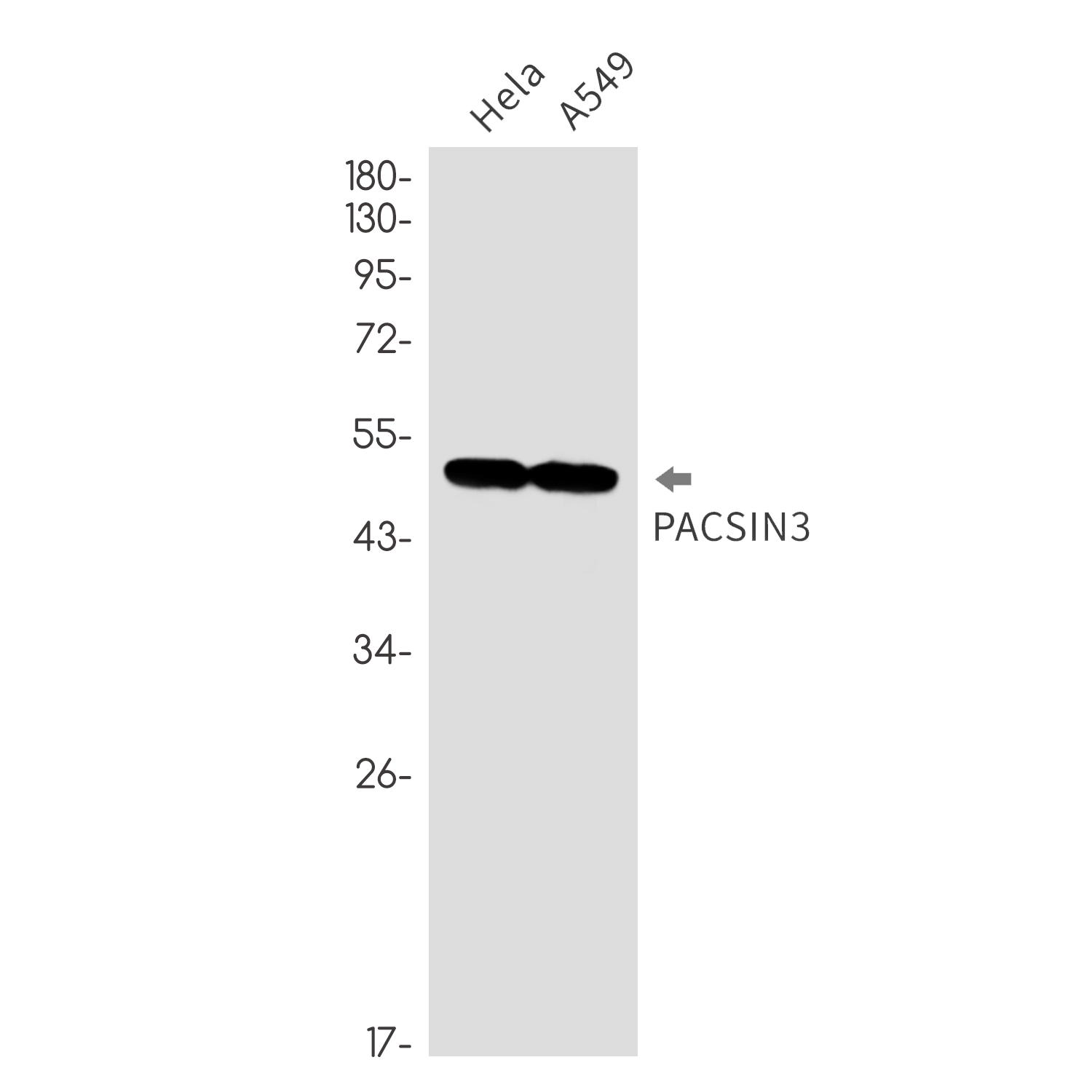 PACSIN3 Rabbit mAb ABZ1762