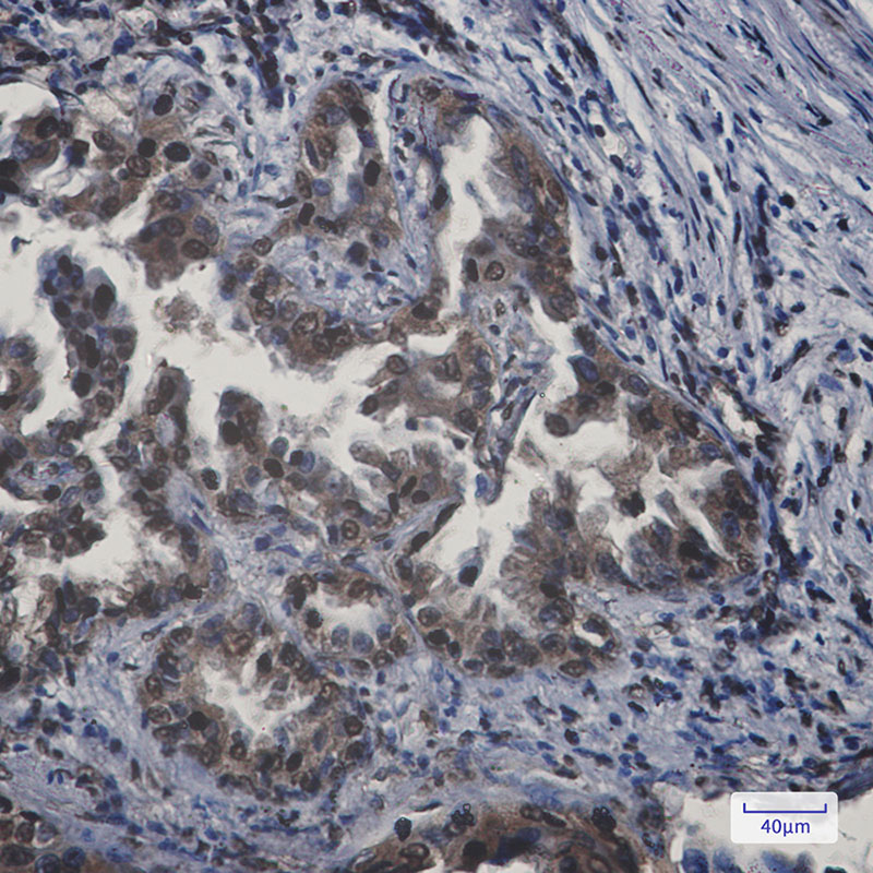 APPL Rabbit mAb ABZ1763