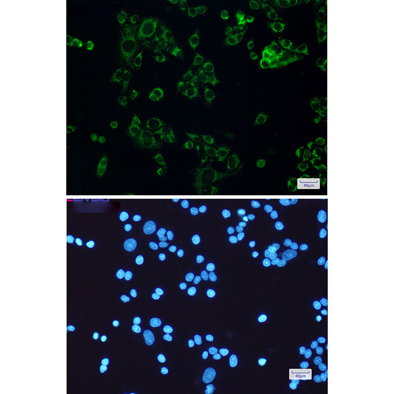 SLP2 Rabbit mAb ABZ1765
