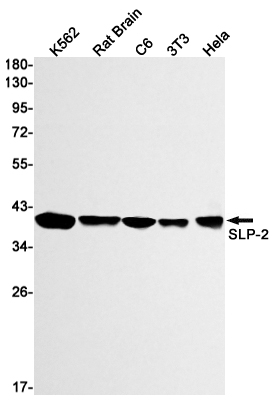 SLP2 Rabbit mAb ABZ1765