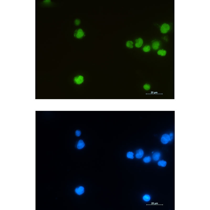 LEF1 Rabbit mAb ABZ1766