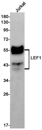 LEF1 Rabbit mAb ABZ1766