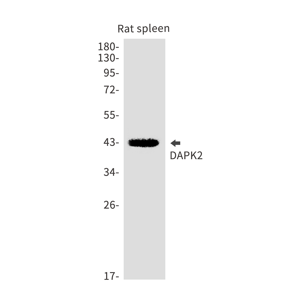 DAPK2 Rabbit mAb ABZ1768