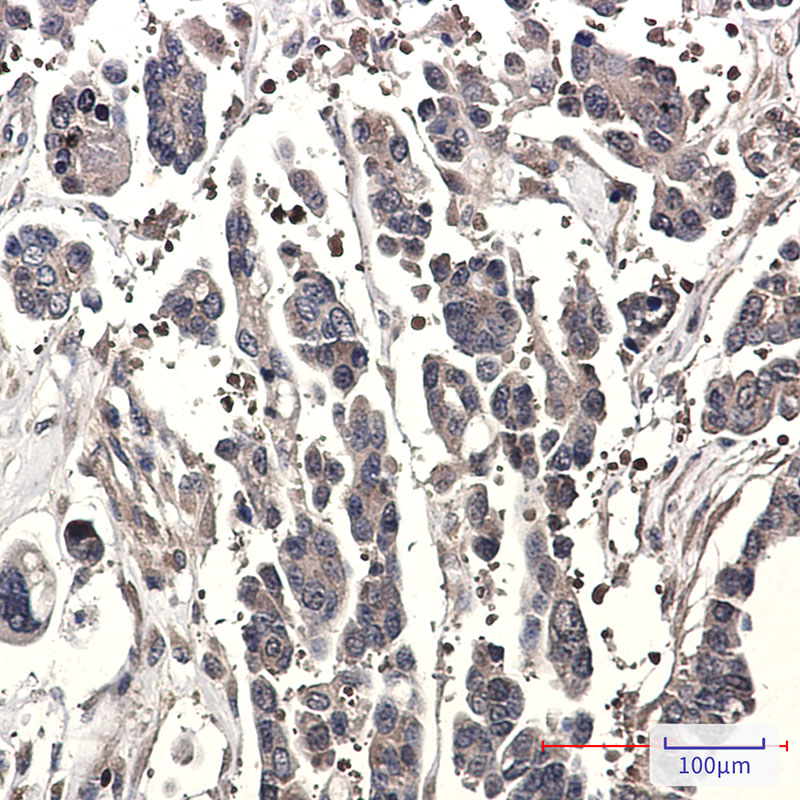 SPAK Rabbit mAb ABZ1770