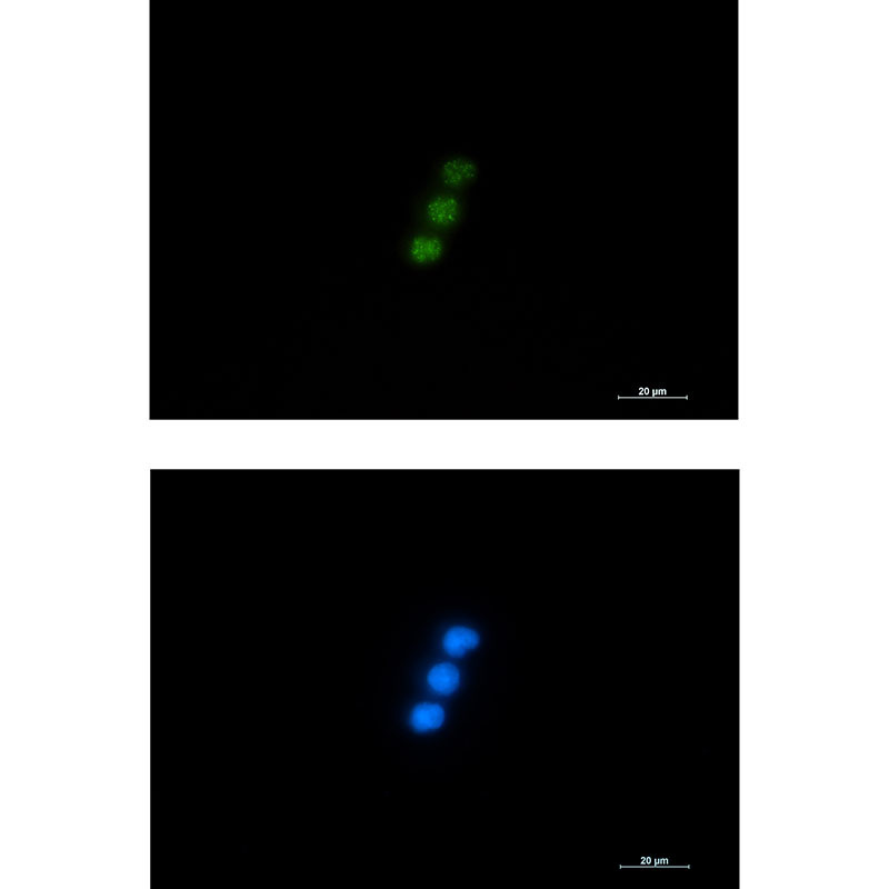 NXF1 Rabbit mAb ABZ1773