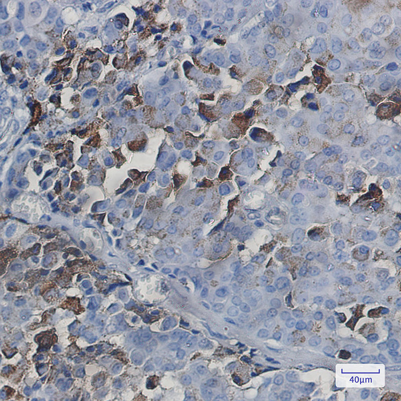 NXF1 Rabbit mAb ABZ1773