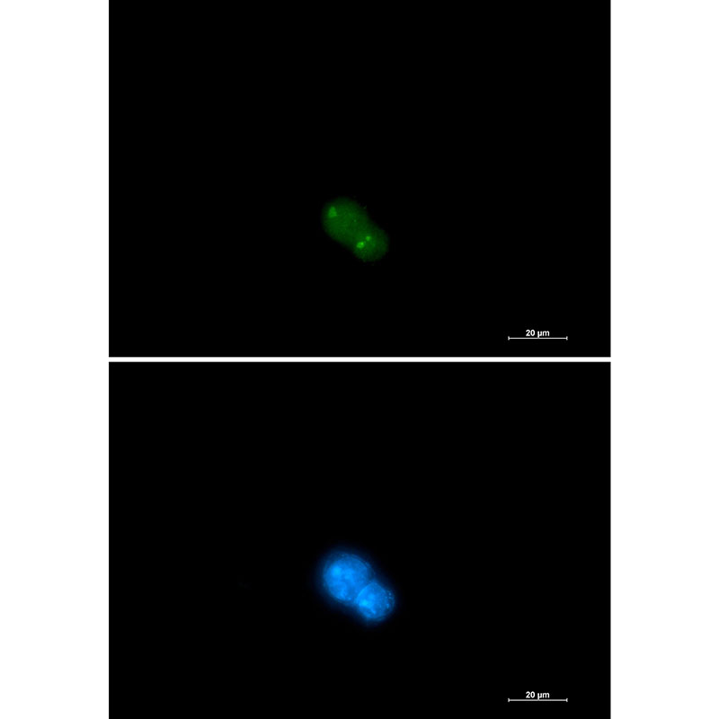 UBA2 Rabbit mAb ABZ1776