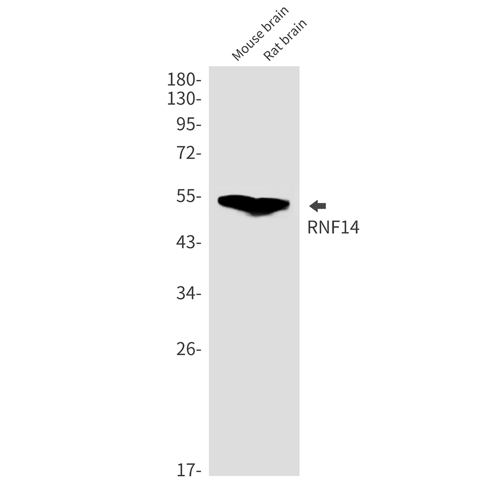 RNF14 Rabbit mAb ABZ1777