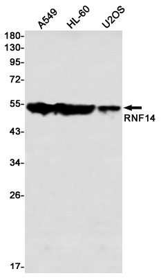 RNF14 Rabbit mAb ABZ1777