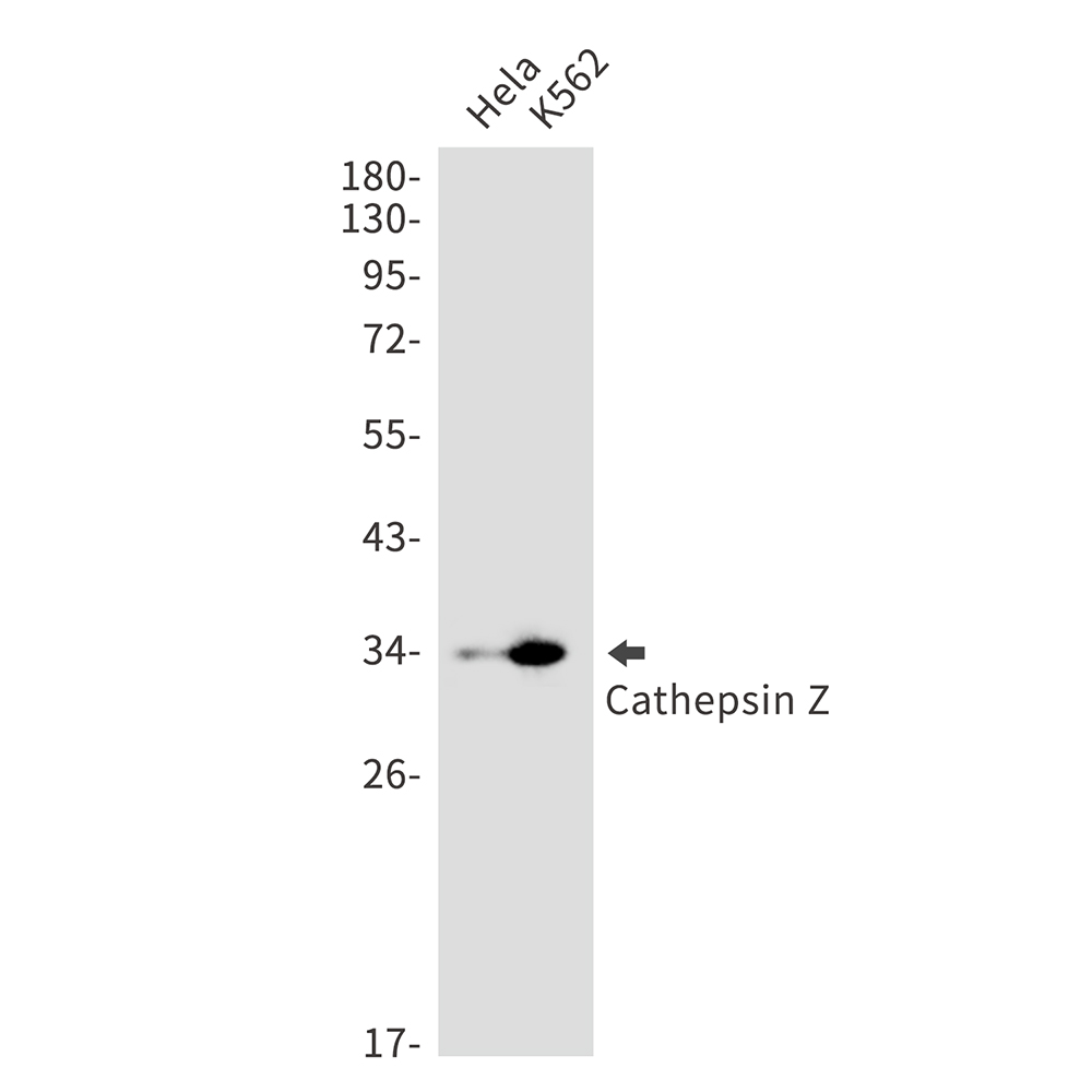 Cathepsin Z Rabbit mAb ABZ1778