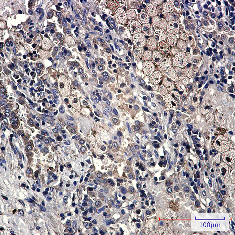 DcR2 Rabbit mAb ABZ1779