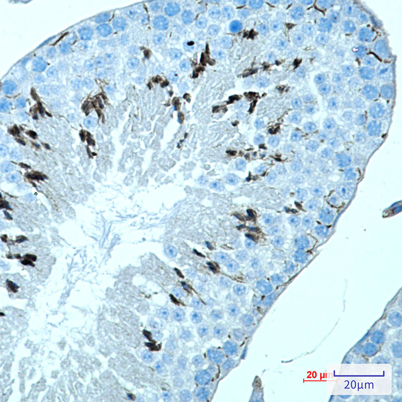 MAGEC2 Rabbit mAb ABZ1781