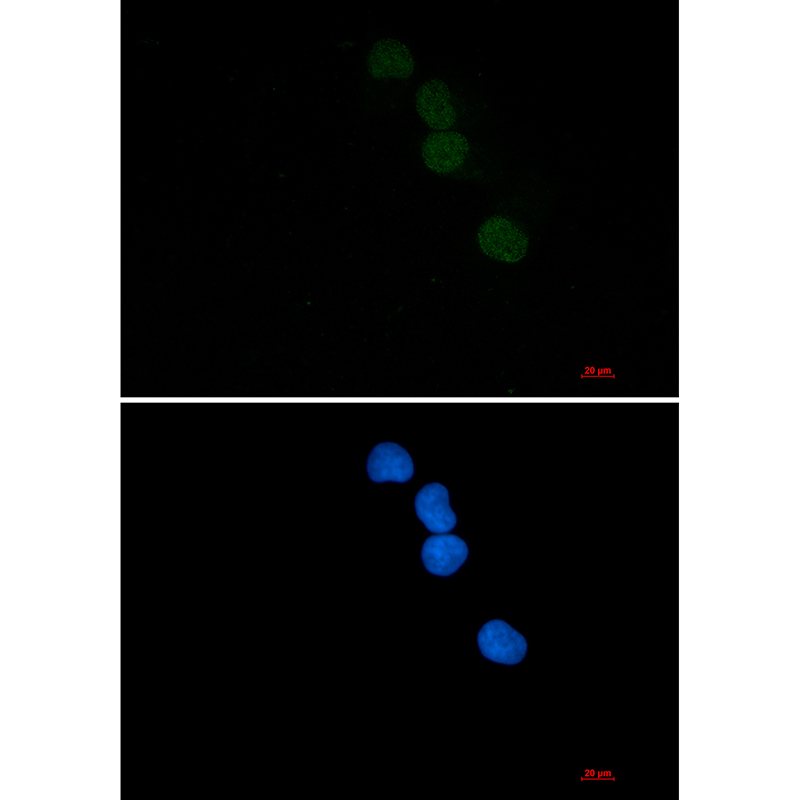 SAE1 Rabbit mAb ABZ1782