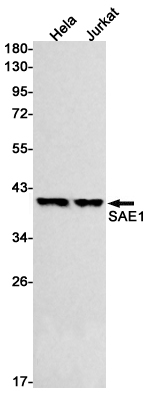 SAE1 Rabbit mAb ABZ1782