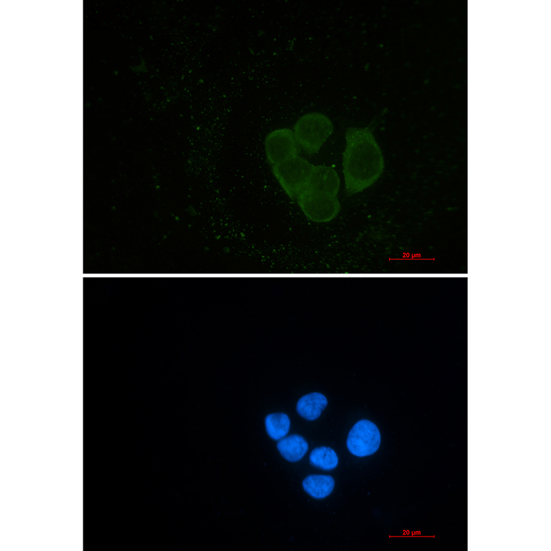 EPS15R Rabbit mAb ABZ1783