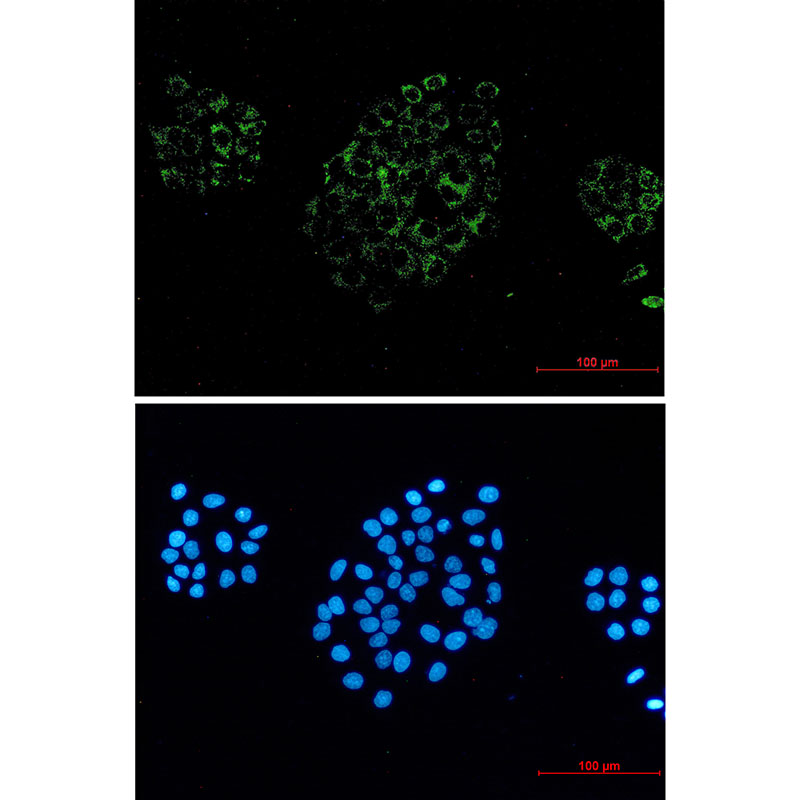 ACOX1 Rabbit mAb ABZ1784