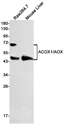ACOX1 Rabbit mAb ABZ1784