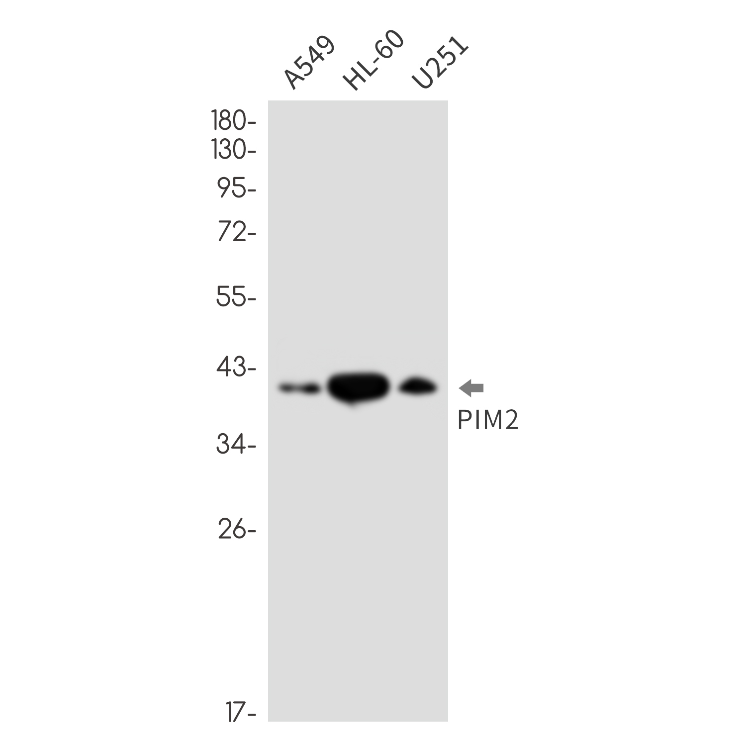 PIM2 Rabbit mAb ABZ1787