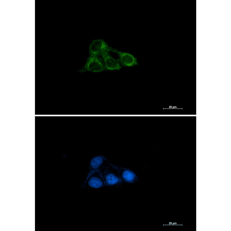NDUFAF4 Rabbit mAb ABZ1789
