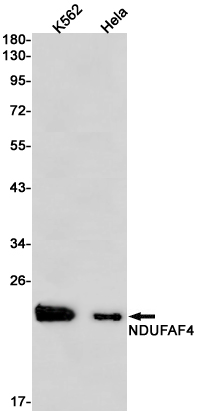 NDUFAF4 Rabbit mAb ABZ1789