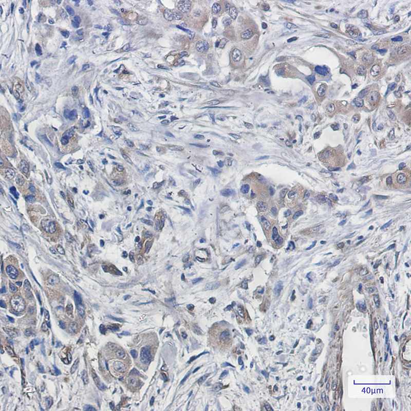 CDT2 Rabbit mAb ABZ1791