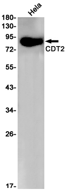 CDT2 Rabbit mAb ABZ1791