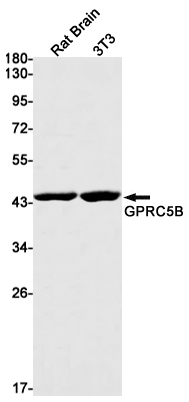 GPRC5B Rabbit mAb ABZ1792