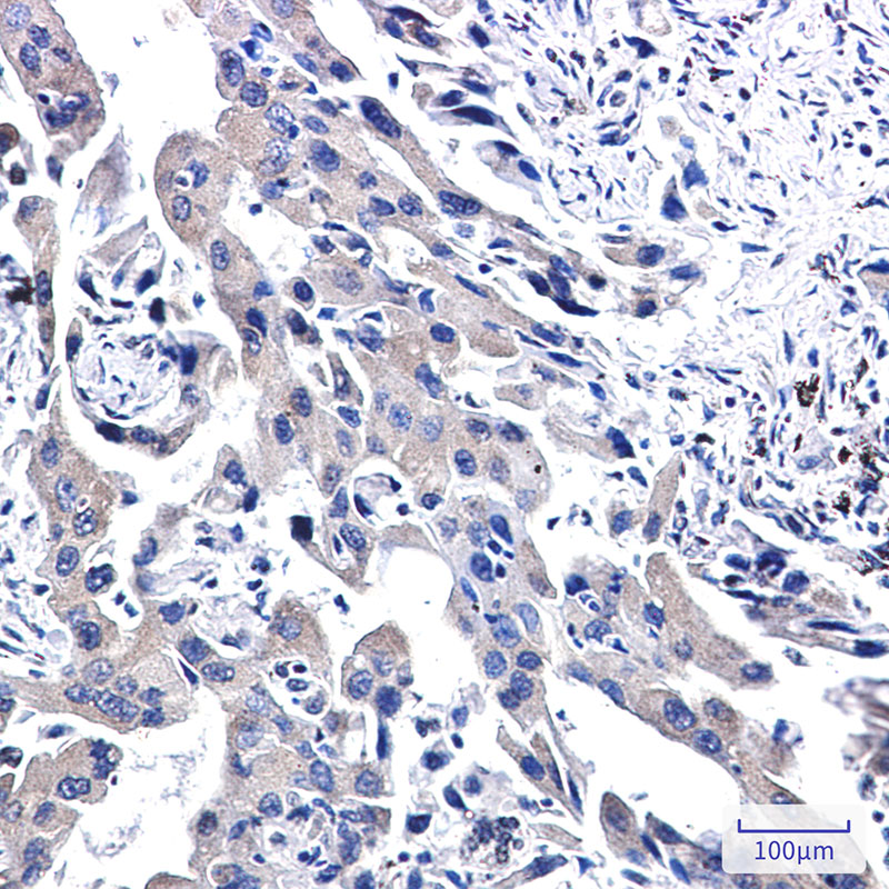 WWOX Rabbit mAb ABZ1793