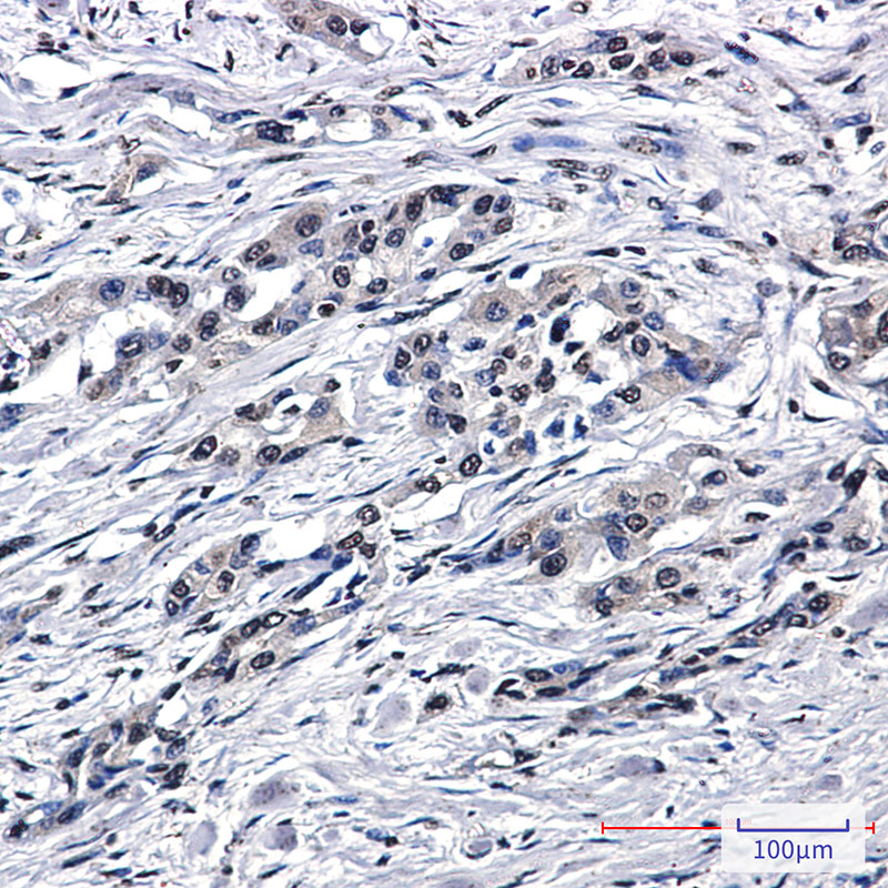 PEN2 Rabbit mAb ABZ1794