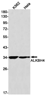 ALKBH4 Rabbit mAb ABZ1796