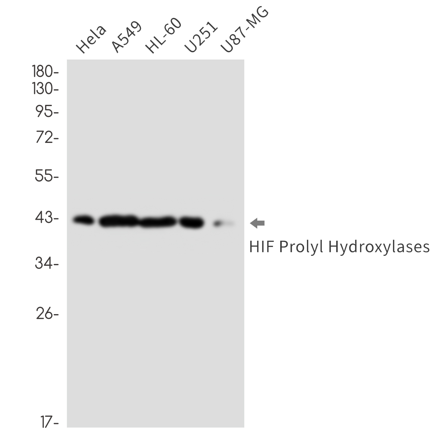HIF Prolyl Hydroxylases Rabbit mAb ABZ1797