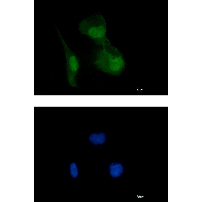 HIF1AN/FIH-1 Rabbit mAb ABZ1800