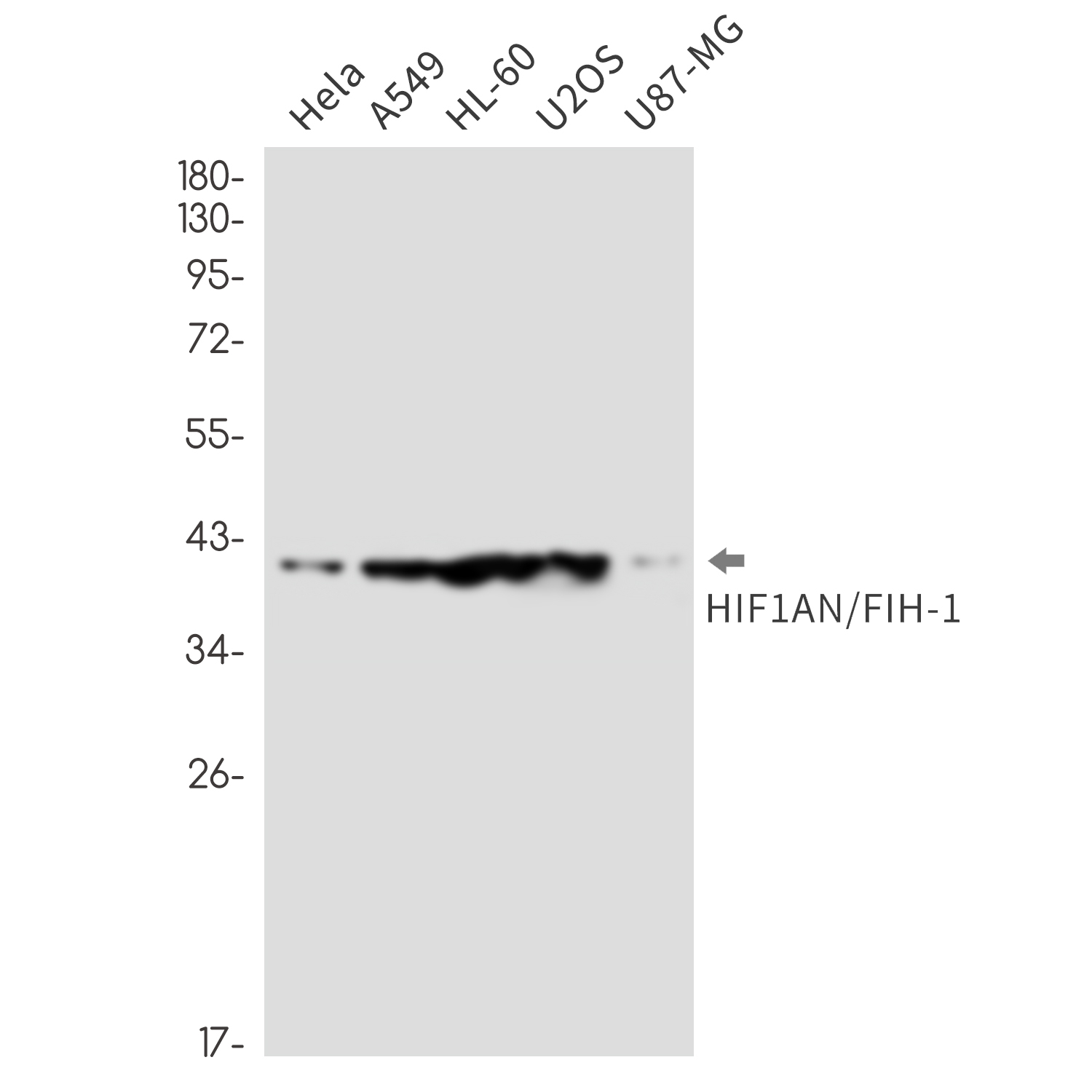 HIF1AN/FIH-1 Rabbit mAb ABZ1800