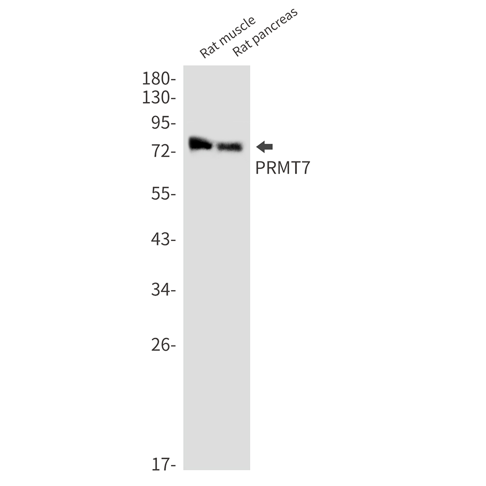 PRMT7 Rabbit mAb ABZ1801