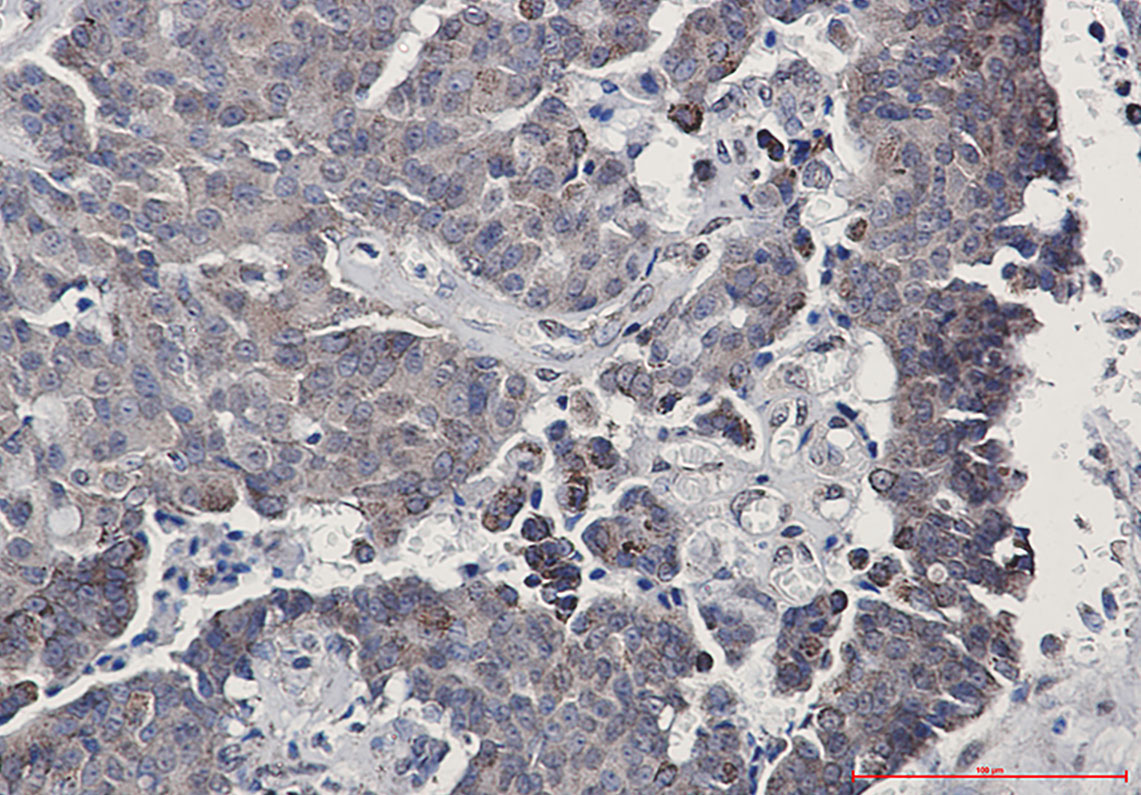 SIRT3 Rabbit mAb ABZ1803