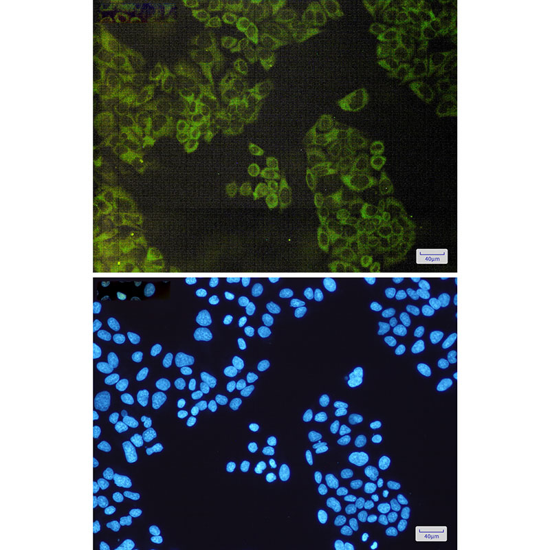 ATG3 Rabbit mAb ABZ1804