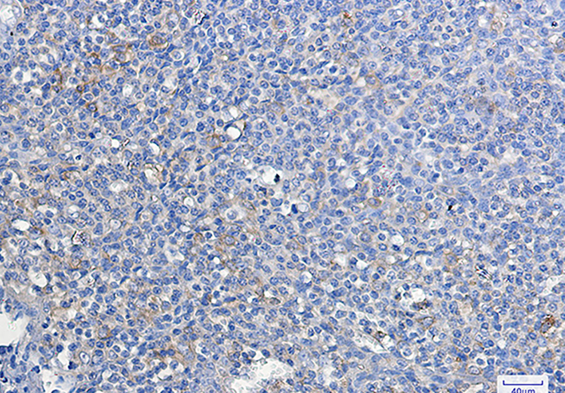 ATG3 Rabbit mAb ABZ1804