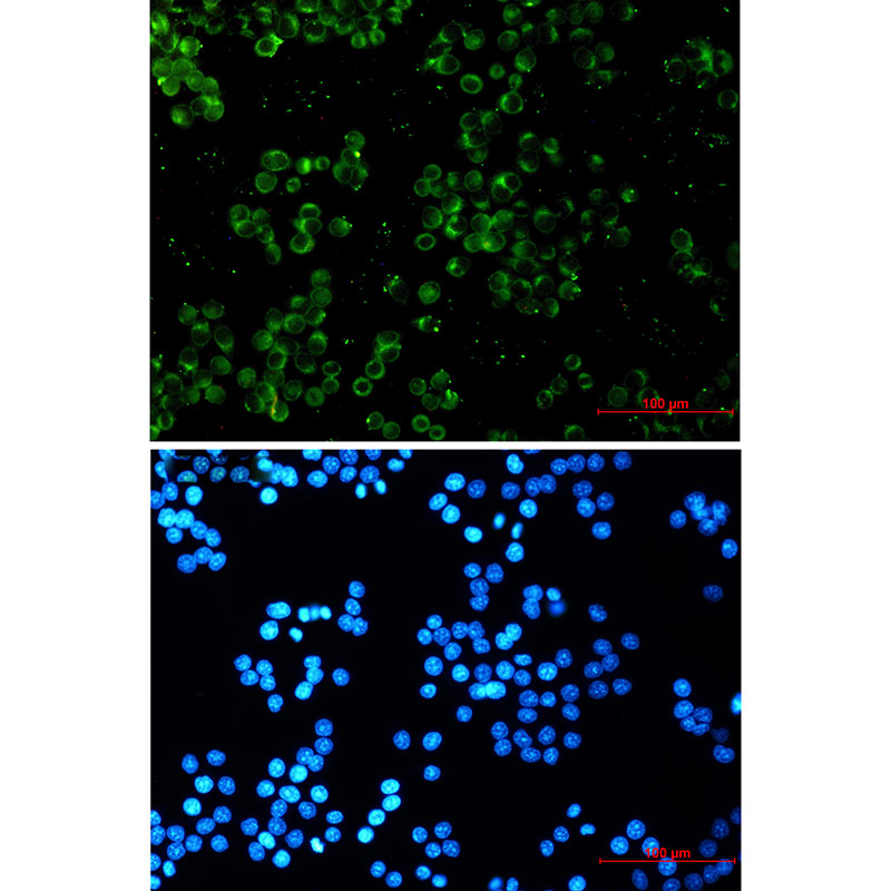 TREX1 Rabbit mAb ABZ1805