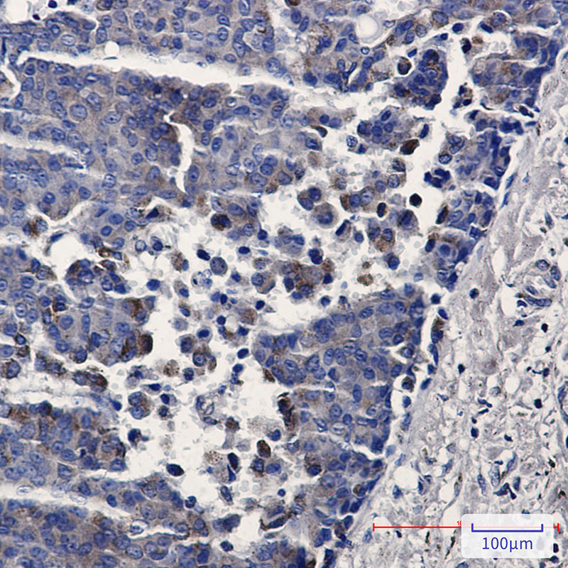 TREX1 Rabbit mAb ABZ1805