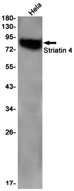 Striatin 4 Rabbit mAb ABZ1807