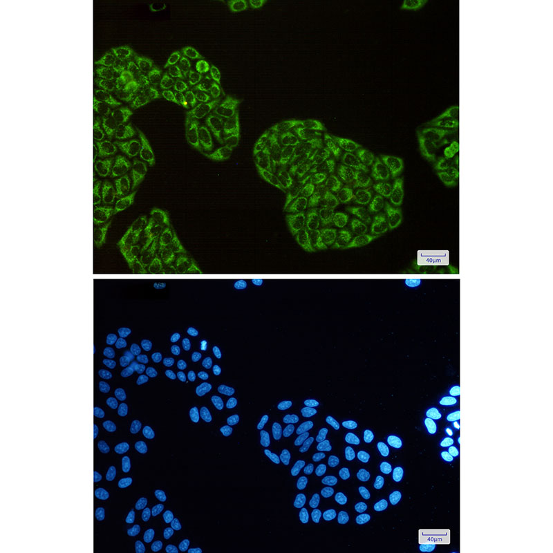 DISC1 Rabbit mAb ABZ1808
