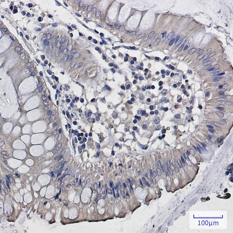 DISC1 Rabbit mAb ABZ1808