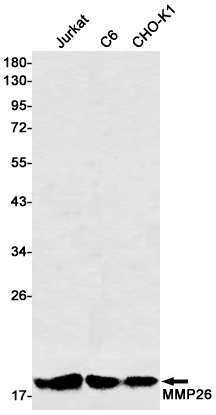 MMP26 Rabbit mAb ABZ1809