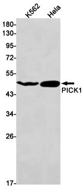 PICK1 Rabbit mAb ABZ1810