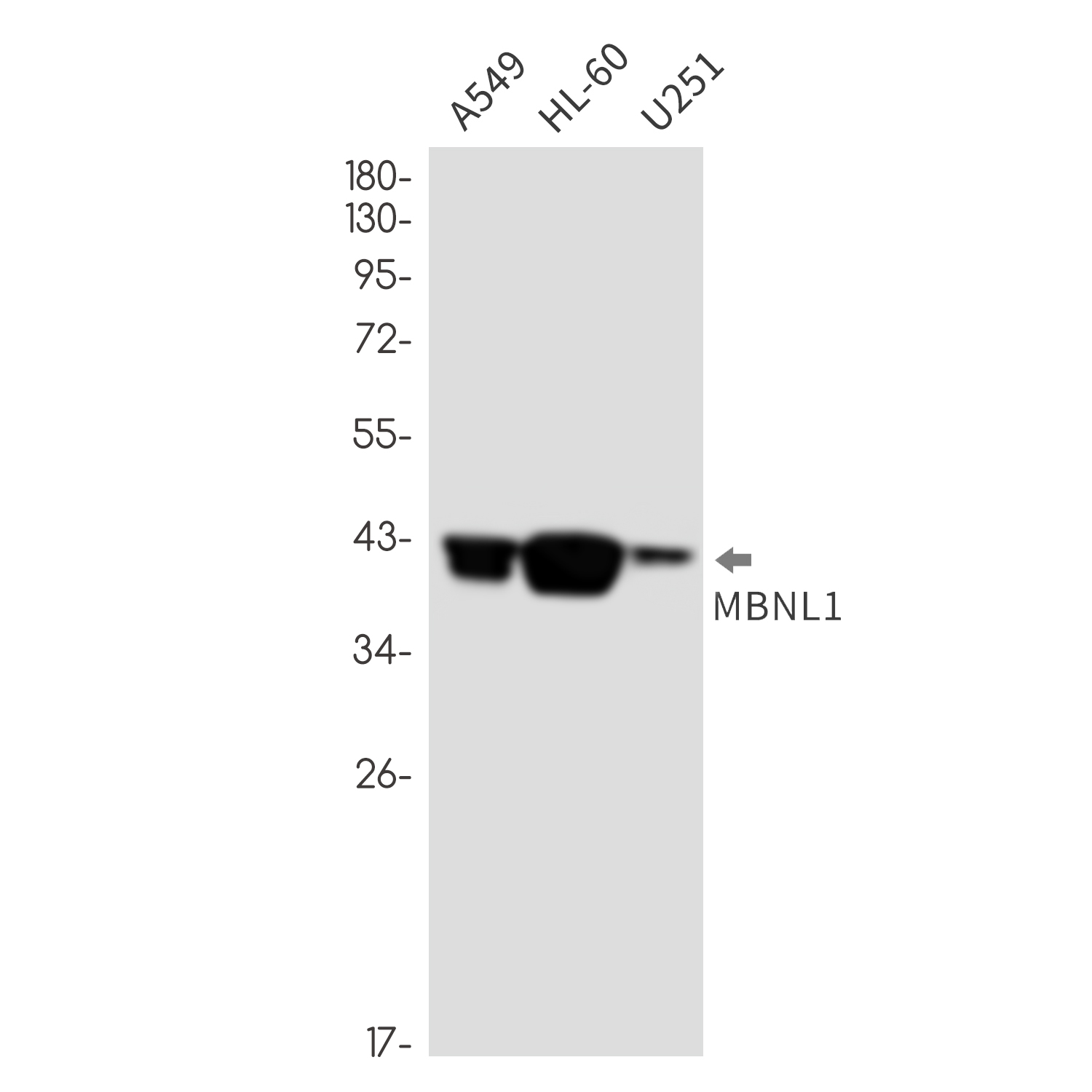 MBNL1 Rabbit mAb ABZ1811